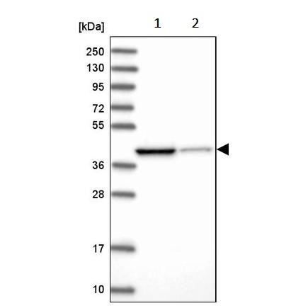 Western blot - Anti-IVD antibody (AB243509), expandable thumbnail