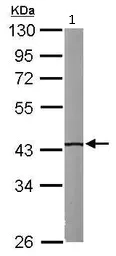 Western blot - Anti-IVD antibody (AB95994)