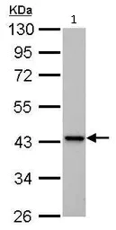 Western blot - Anti-IVD antibody (AB95994)