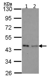 Western blot - Anti-IVD antibody (AB95994)