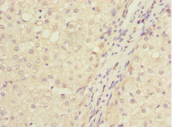 Immunohistochemistry (Formalin/PFA-fixed paraffin-embedded sections) - Anti-IWS1 antibody (AB230183)