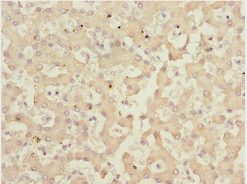 Immunohistochemistry (Formalin/PFA-fixed paraffin-embedded sections) - Anti-IWS1 antibody (AB230183)