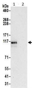 Immunoprecipitation - Anti-IWS1 antibody - N-terminal (AB195309)
