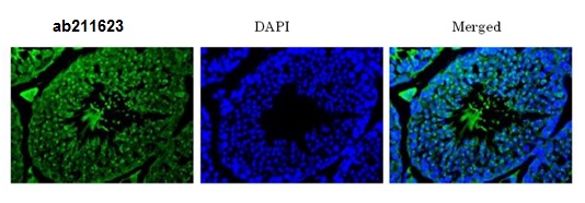 Immunohistochemistry (Formalin/PFA-fixed paraffin-embedded sections) - Anti-IZUMO1 antibody (AB211623), expandable thumbnail