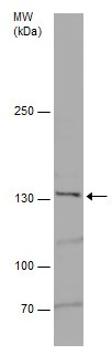 Western blot - Anti-Jagged 2/JAG2 antibody (AB226814), expandable thumbnail