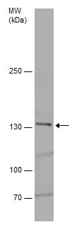 Western blot - Anti-Jagged 2/JAG2 antibody (AB226814)