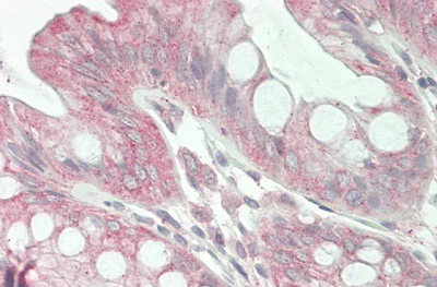 Immunohistochemistry (Formalin/PFA-fixed paraffin-embedded sections) - Anti-Jagged1 antibody (AB233101)