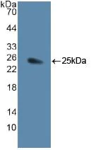 Western blot - Anti-Jagged1 antibody (AB233101)