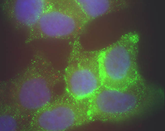 Immunocytochemistry/ Immunofluorescence - Anti-Jagged1 antibody (AB7771), expandable thumbnail