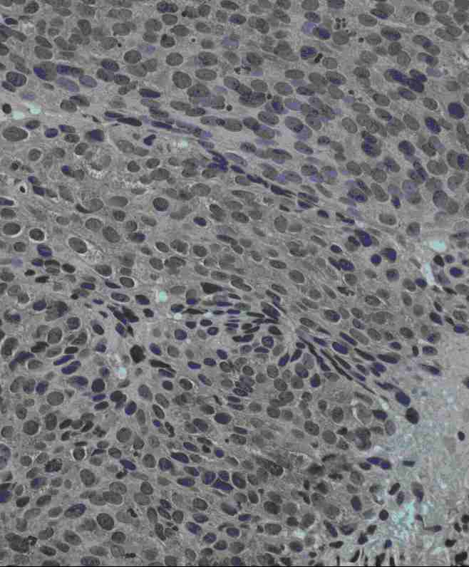 Immunohistochemistry (Formalin/PFA-fixed paraffin-embedded sections) - Anti-Jagged1 antibody (AB7771), expandable thumbnail