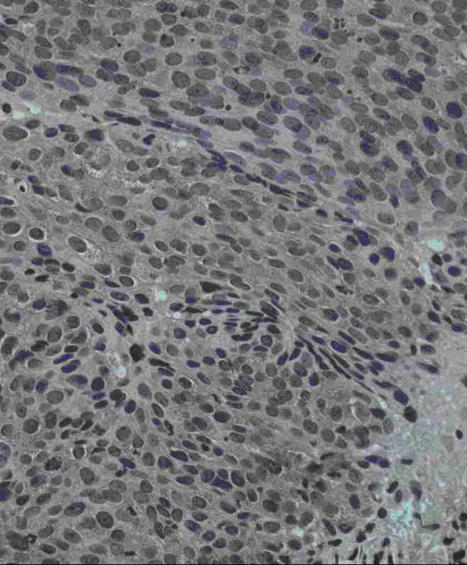 Immunohistochemistry (Formalin/PFA-fixed paraffin-embedded sections) - Anti-Jagged1 antibody (AB7771)