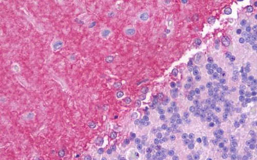 Immunohistochemistry (Formalin/PFA-fixed paraffin-embedded sections) - Anti-Jagged1 antibody - C-terminal (AB192767)