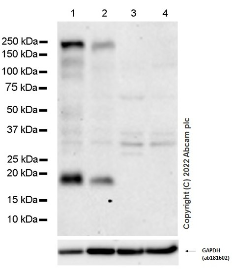 Western blot - Anti-Jagged1 antibody [EPR4290] (AB109536), expandable thumbnail
