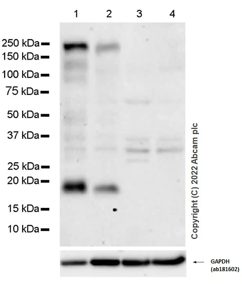 Western blot - Anti-Jagged1 antibody [EPR4290] (AB109536)