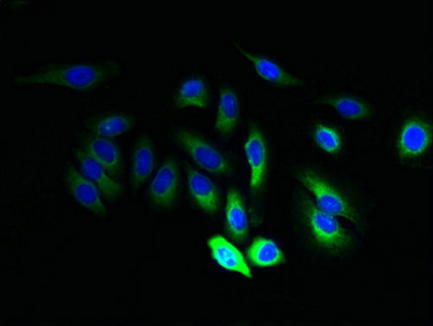 Immunocytochemistry/ Immunofluorescence - Anti-JAGN1 antibody (AB237735), expandable thumbnail