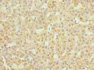 Immunohistochemistry (Formalin/PFA-fixed paraffin-embedded sections) - Anti-JAGN1 antibody (AB237735)