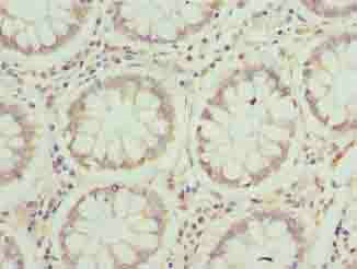 Immunohistochemistry (Formalin/PFA-fixed paraffin-embedded sections) - Anti-JAGN1 antibody (AB237735), expandable thumbnail
