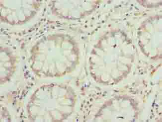 Immunohistochemistry (Formalin/PFA-fixed paraffin-embedded sections) - Anti-JAGN1 antibody (AB237735)
