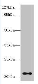 Western blot - Anti-JAGN1 antibody (AB237735), expandable thumbnail
