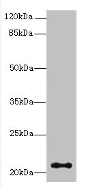 Western blot - Anti-JAGN1 antibody (AB237735)