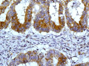 Immunohistochemistry (Formalin/PFA-fixed paraffin-embedded sections) - Anti-JAK1 (phospho Y1034 + Y1035) antibody [EPR1899(2)] (AB138005)
