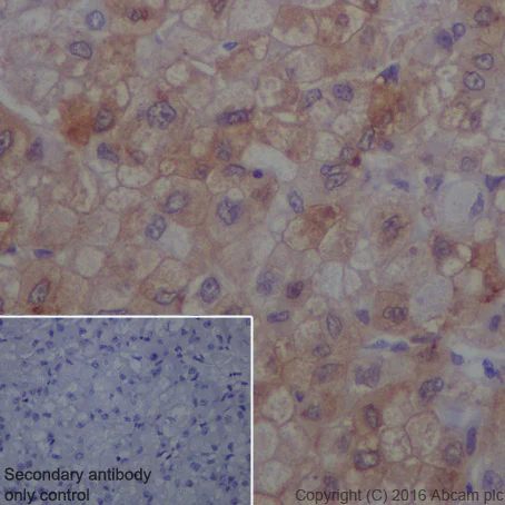 Immunohistochemistry (Formalin/PFA-fixed paraffin-embedded sections) - Anti-JAK1 (phospho Y1034 + Y1035) antibody [EPR1899(2)] - BSA and Azide free (AB203784)