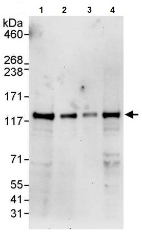 Western blot - Anti-JAK2 antibody (AB245303)