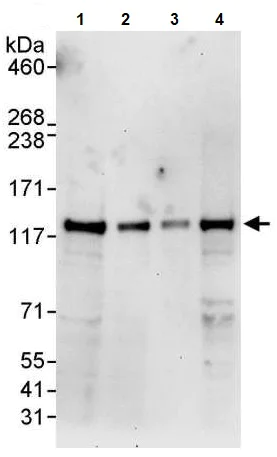 Western blot - Anti-JAK2 antibody (AB245303)