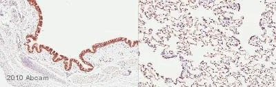 Immunohistochemistry (Formalin/PFA-fixed paraffin-embedded sections) - Anti-JAK2 antibody (AB39636)