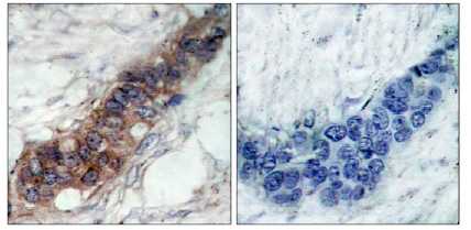 Immunohistochemistry (Formalin/PFA-fixed paraffin-embedded sections) - Anti-JAK2 antibody (AB39636), expandable thumbnail