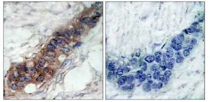 Immunohistochemistry (Formalin/PFA-fixed paraffin-embedded sections) - Anti-JAK2 antibody (AB39636)