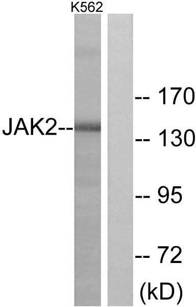 Western blot - Anti-JAK2 antibody (AB39636), expandable thumbnail