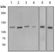 Western blot - Anti-JAK2 antibody [EPR108(2)] (AB108596)