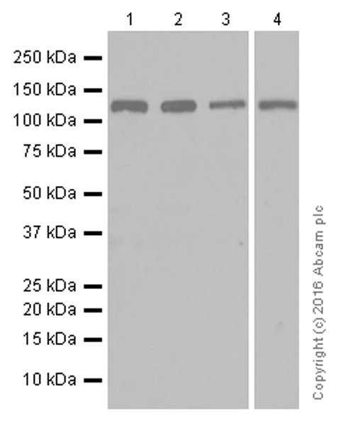 Western blot - Anti-JAK2 antibody [EPR108(2)] (AB108596)