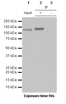 Immunoprecipitation - Anti-JAK2 antibody [EPR108(2)] - BSA and Azide free (AB170718), expandable thumbnail