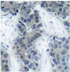 Immunohistochemistry (Formalin/PFA-fixed paraffin-embedded sections) - Anti-JAK2 (phospho Y1007) antibody (AB195055), expandable thumbnail