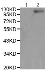 Western blot - Anti-JAK2 (phospho Y1007) antibody (AB195055), expandable thumbnail