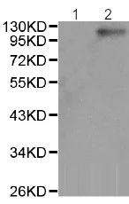 Western blot - Anti-JAK2 (phospho Y1007) antibody (AB195055)