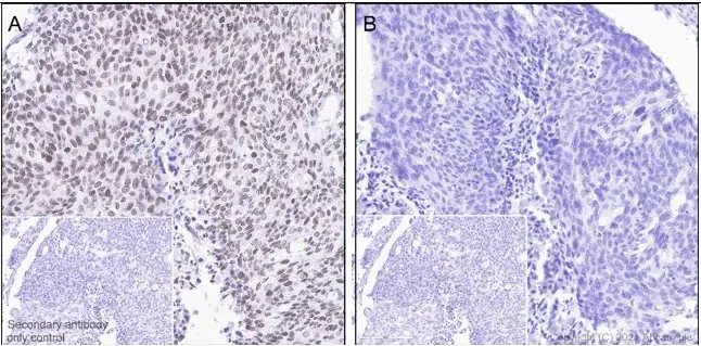 Immunohistochemistry (Formalin/PFA-fixed paraffin-embedded sections) - Anti-JAK2 (phospho Y1007 + Y1008) + JAK1 (phospho Y1034 + Y1035) antibody [E132] (AB32101)