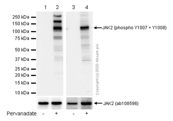 Western blot - Anti-JAK2 (phospho Y1007 + Y1008) + JAK1 (phospho Y1034 + Y1035) antibody [E132] (AB32101), expandable thumbnail