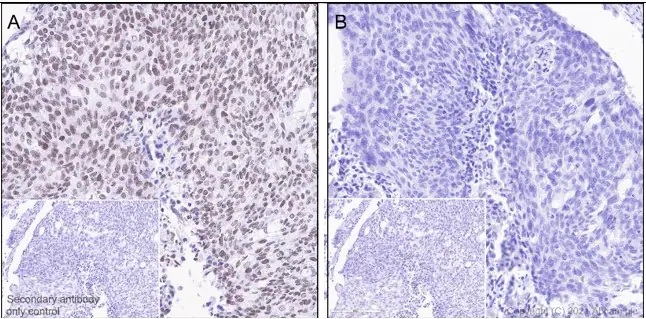 Immunohistochemistry (Formalin/PFA-fixed paraffin-embedded sections) - Anti-JAK2 (phospho Y1007 + Y1008) + JAK1 (phospho Y1034 + Y1035) antibody [E132] - BSA and Azide free (ab219728), expandable thumbnail