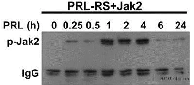 Western blot - Anti-JAK2 (phospho Y1007 + Y1008) + JAK1 (phospho Y1034 + Y1035) antibody [E132] - BSA and Azide free (AB219728)