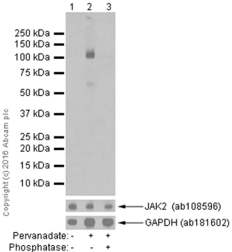 Western blot - Anti-JAK2 (phospho Y1007 + Y1008) + JAK1 (phospho Y1034 + Y1035) antibody [E132] - BSA and Azide free (AB219728)