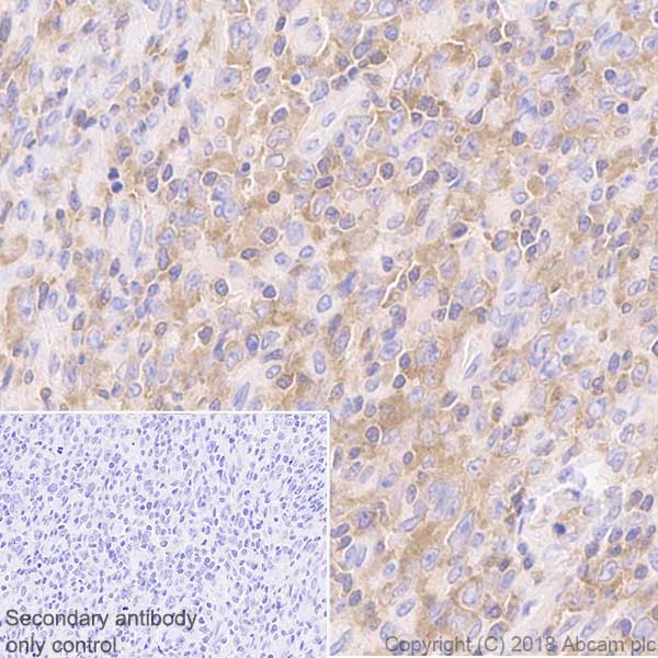 Immunohistochemistry (Formalin/PFA-fixed paraffin-embedded sections) - Anti-JAK3 antibody [EP909Y] (AB45141)