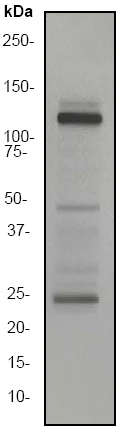 Western blot - Anti-JAK3 antibody [EP909Y] (AB45141)
