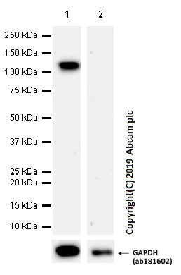 Western blot - Anti-JAK3 antibody [EP909Y] (AB45141)