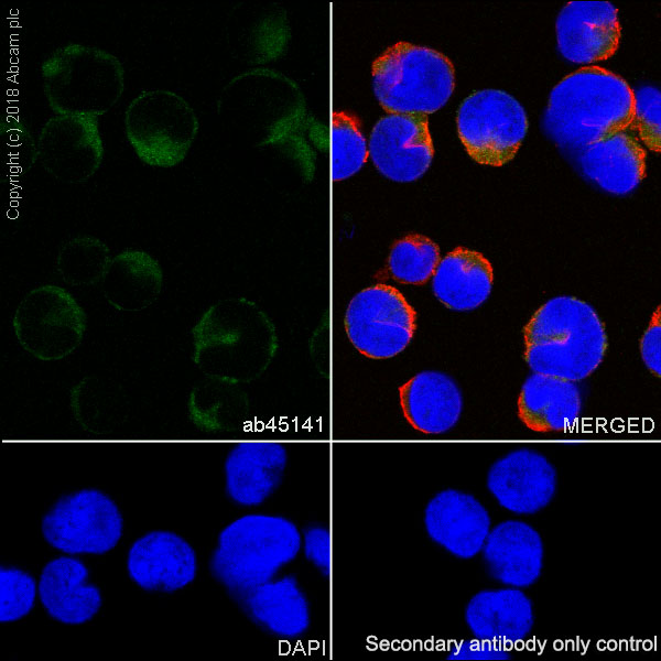 Immunocytochemistry/ Immunofluorescence - Anti-JAK3 antibody [EP909Y] - BSA and Azide free (AB232005)