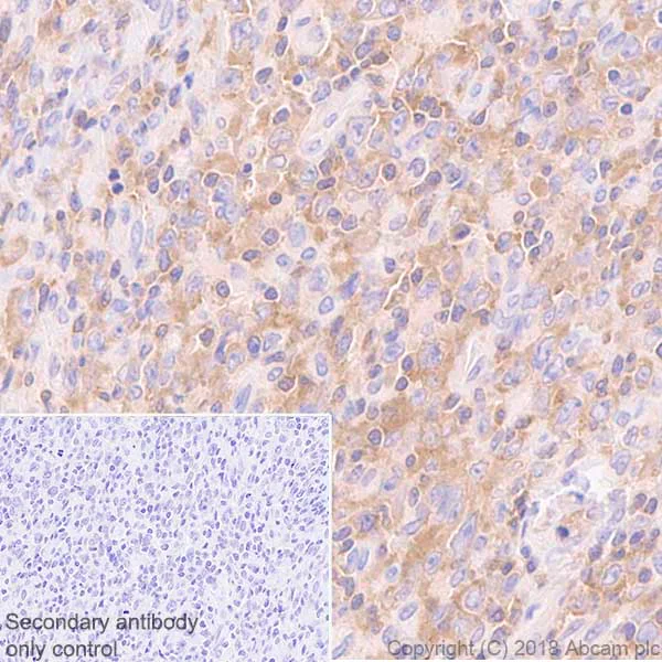 Immunohistochemistry (Formalin/PFA-fixed paraffin-embedded sections) - Anti-JAK3 antibody [EP909Y] - BSA and Azide free (AB232005)