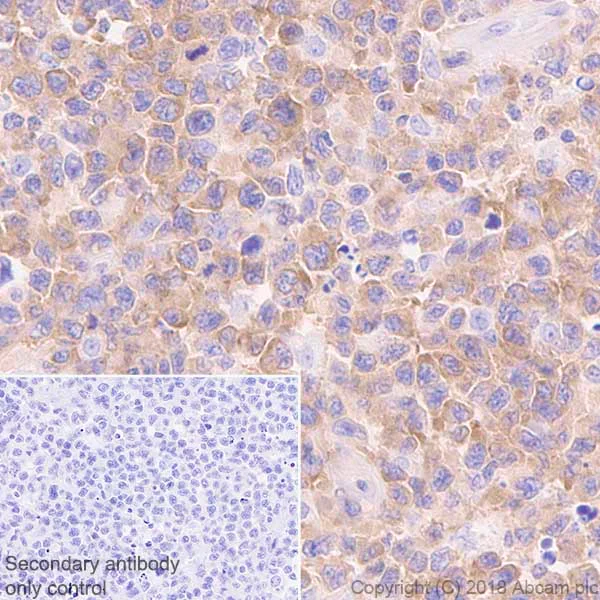 Immunohistochemistry (Formalin/PFA-fixed paraffin-embedded sections) - Anti-JAK3 antibody [EP909Y] - BSA and Azide free (AB232005)