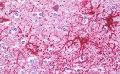 Immunohistochemistry (Formalin/PFA-fixed paraffin-embedded sections) - Anti-JAKMIP1 antibody (AB211296)